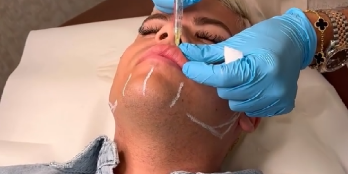 Uroš Stanić na korekciji celog lica