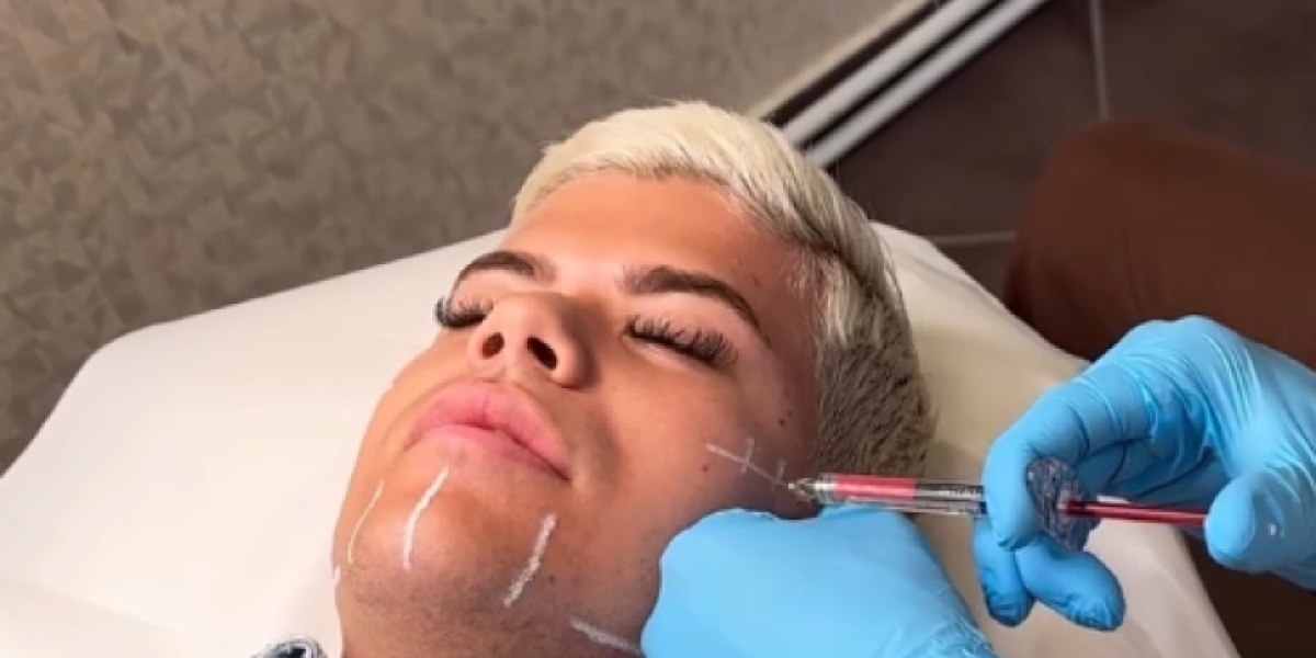 Uroš Stanić na korekciji celog lica