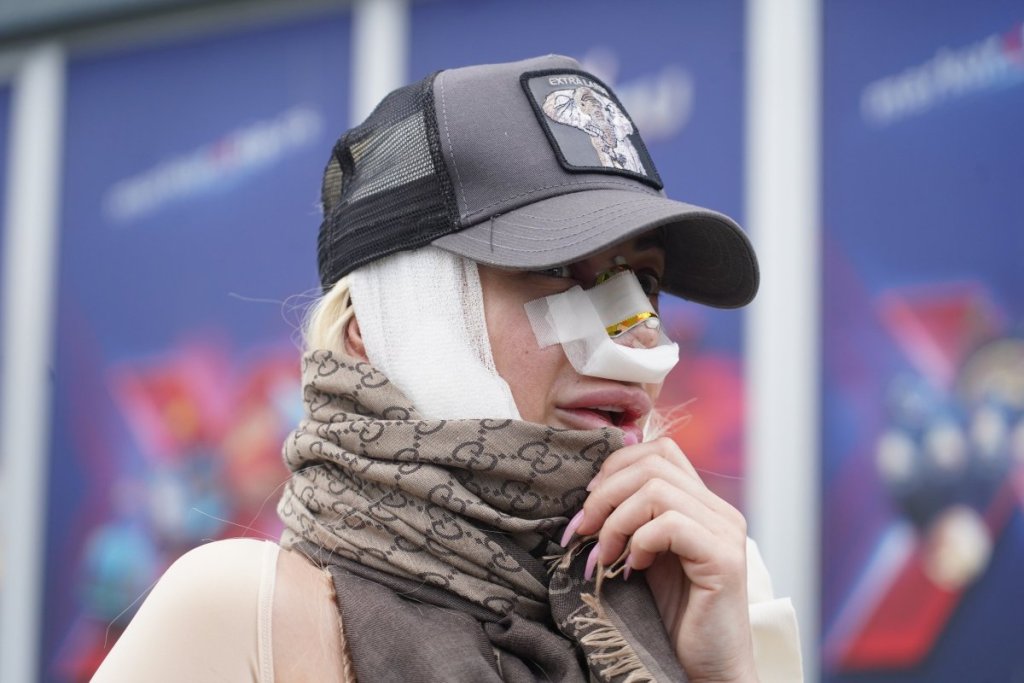 "Veći karton na klinici od Majkla Džeksona": Dušica Jakovljević o estetskim zahvatima