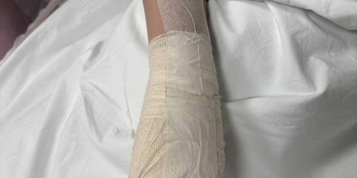 Dečaku iz Niša amputiran prst