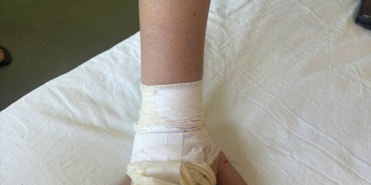 Dečaku iz Niša amputiran prst