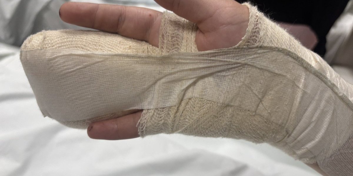 Dečaku iz Niša amputiran prst