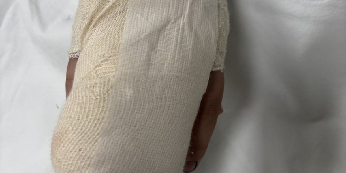 Dečaku iz Niša amputiran prst