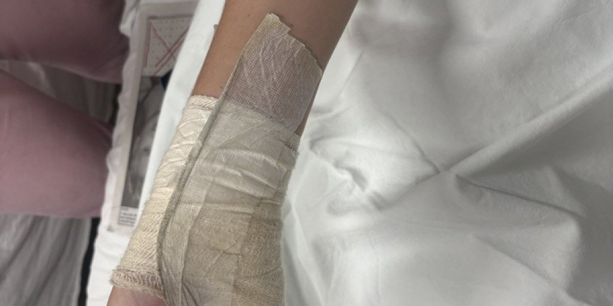 Dečaku iz Niša amputiran prst