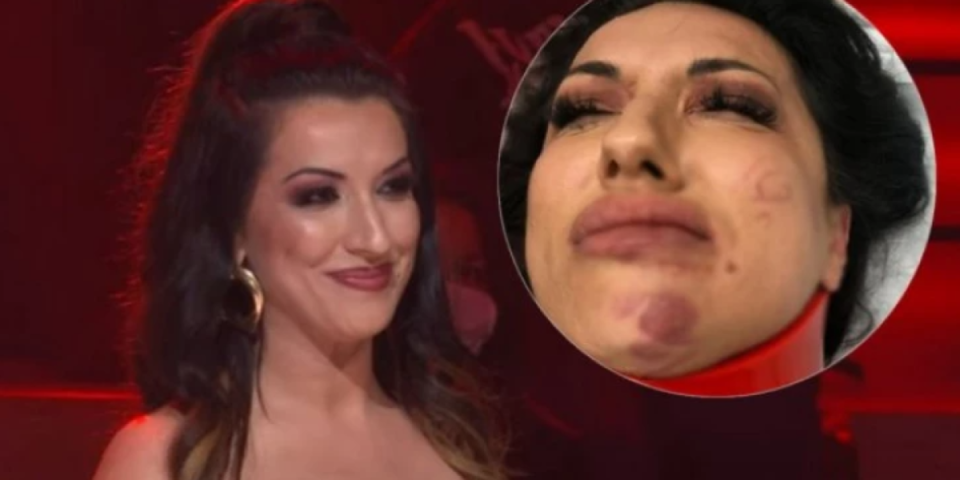 Zapaljen automobil i deo kuće naše pevačice: "Ovo je pokušaj ubistva"