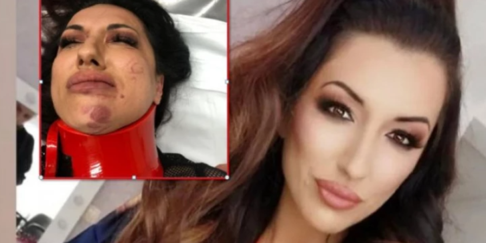 Unakazili je: Pevačicu krvnički pretukli - Polomljena primljena u bolnicu