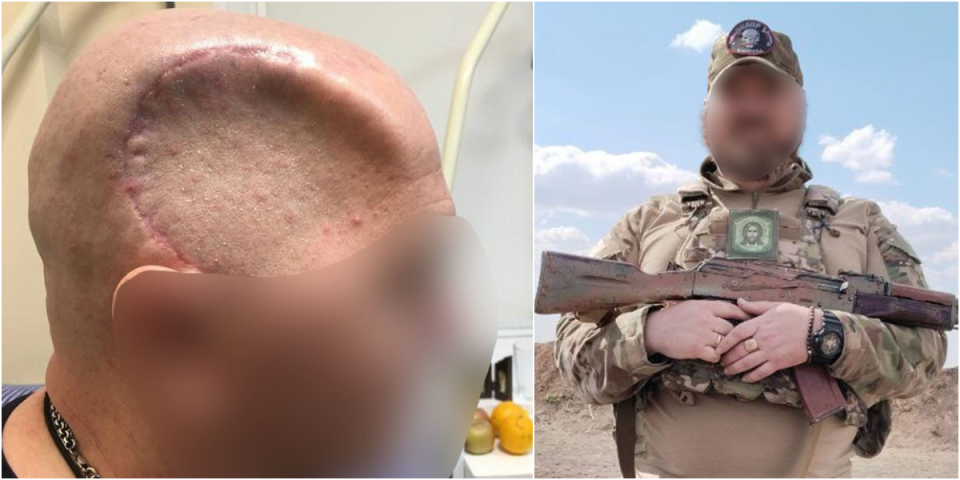 (FOTO) Šta je ovaj Rus preživeo?! Neće vam biti dobro kada vidite slike: Šokantne scene obišle svet