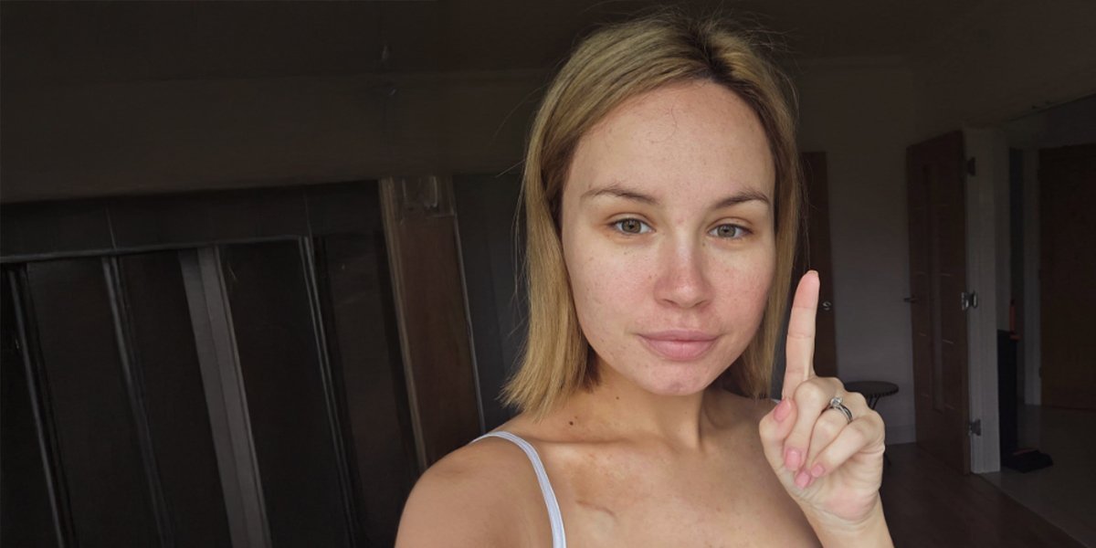 Doktori 10 godina ignorisali njene simptome: Opaka bolest je urnisala - trpi nesnosne bolove (FOTO)