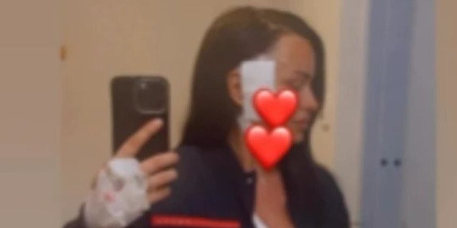 Bivšoj zadrugarki izvađen tumor iz glave - Oglasila se nakon teške operacije: "Živa sam"