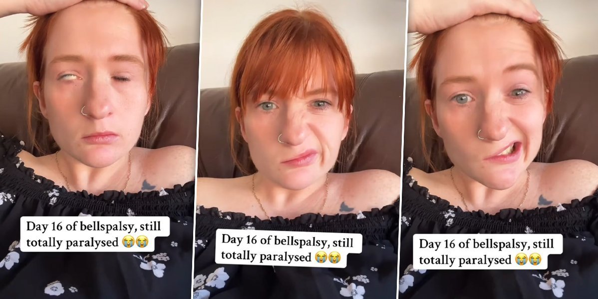 Popila šolju čaja i ostala paralizovana: Ne može da se nasmeje, a oči lepi selotejpom da bi spavala (VIDEO)