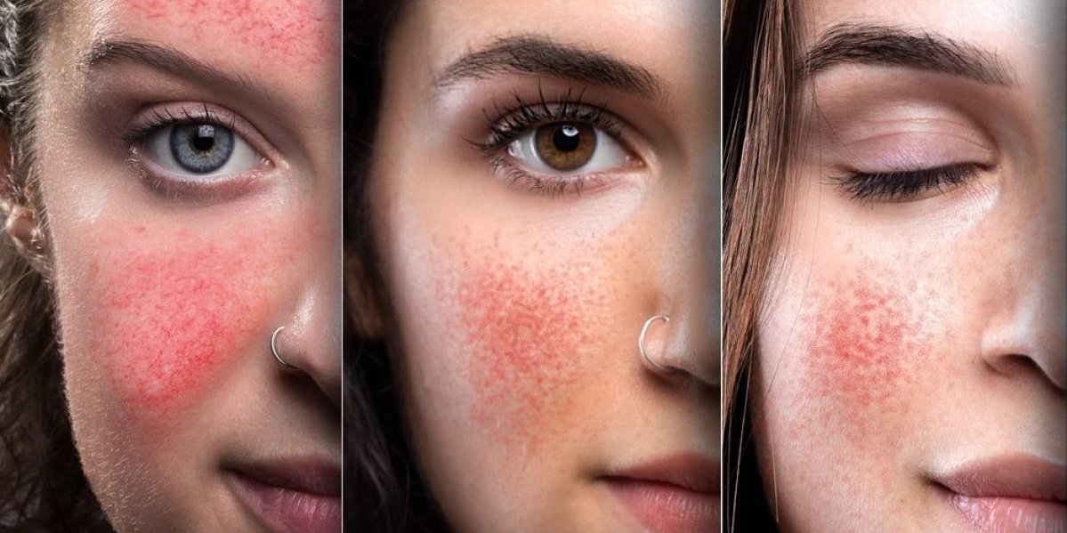 Da li i vi imate "jesenje lice"? Dermatolog upozorio da jednu stvar nikako ne smete da radite