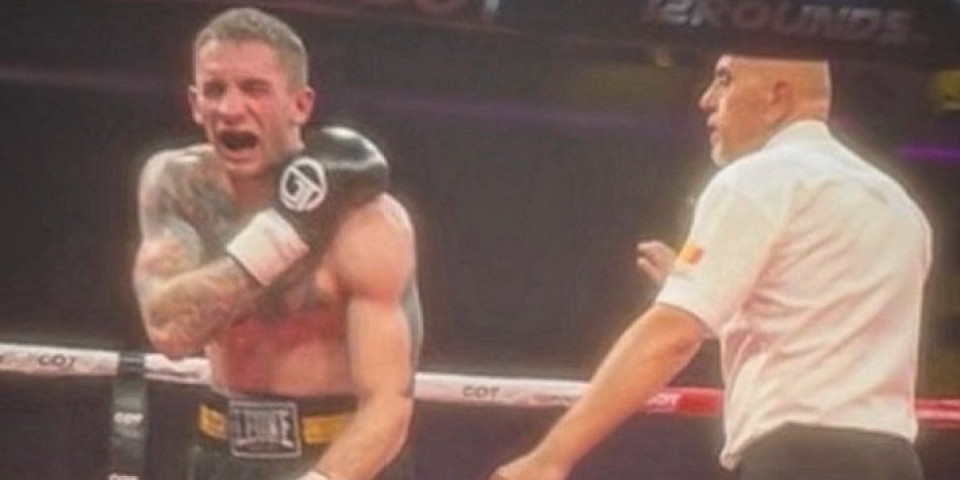 Skandal kakav se ne pamti - Pogledajte povredu srpskog boksera posle ugriza Albanca