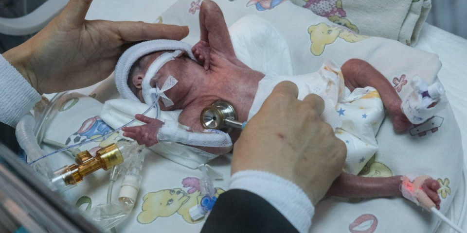Medicinsko čudo: Devojčica od 300 grama preživela zahvaljujući lekarima, malo joj falilo za Ginisov rekord (FOTO)