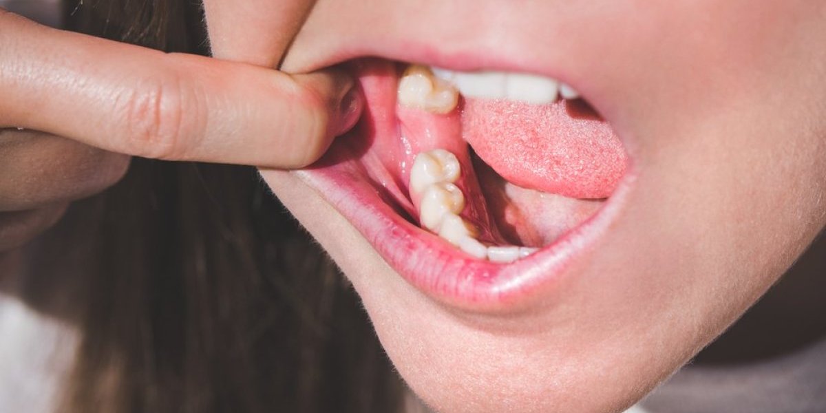 Svako vađenje zuba stari mozak: Šokantno saznanje naučnika - evo i koliko godina