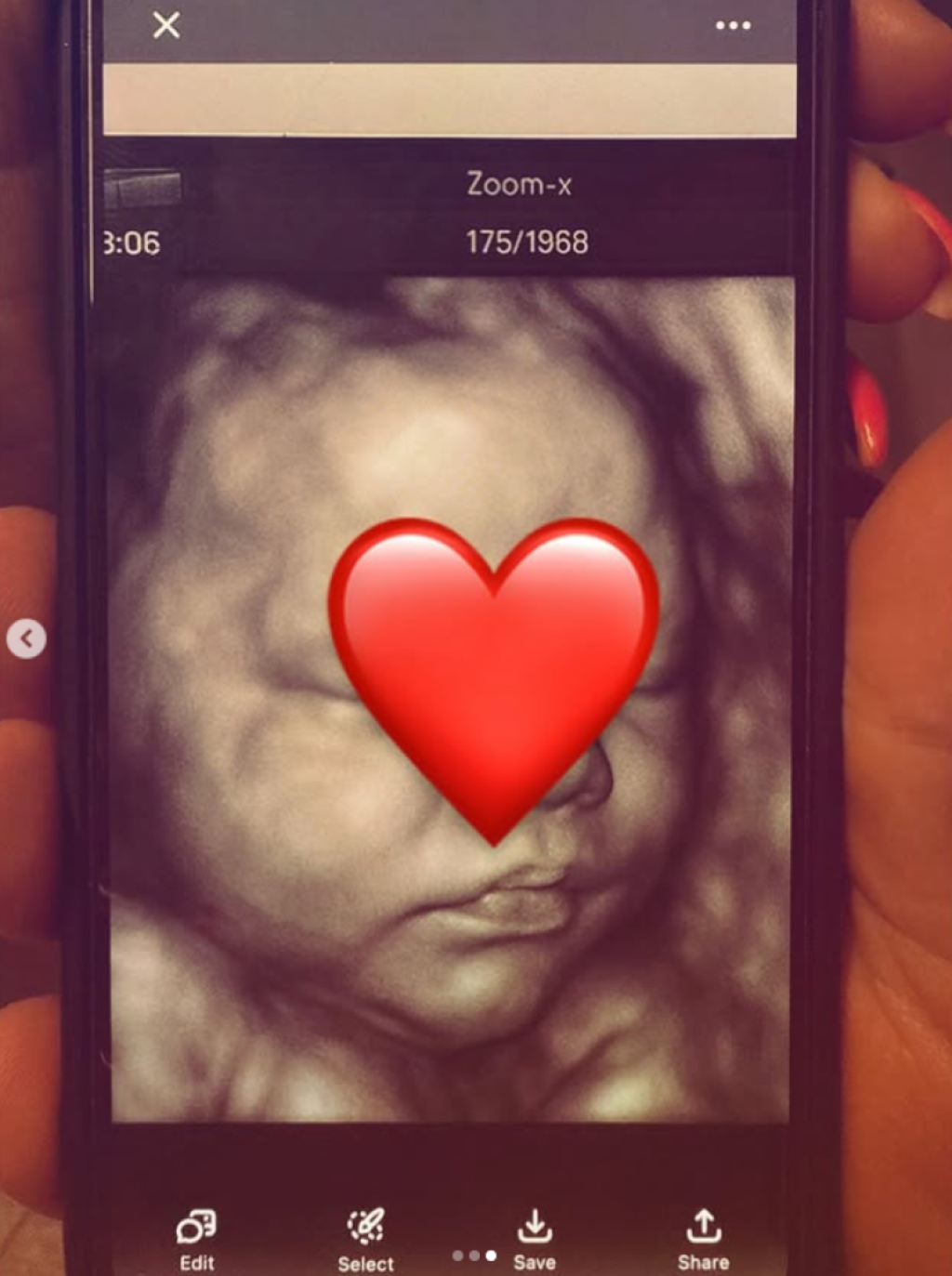 Trudna Marijana Zonjić: Krila stomak do devetog meseca, poznato ime i pol bebe (FOTO)