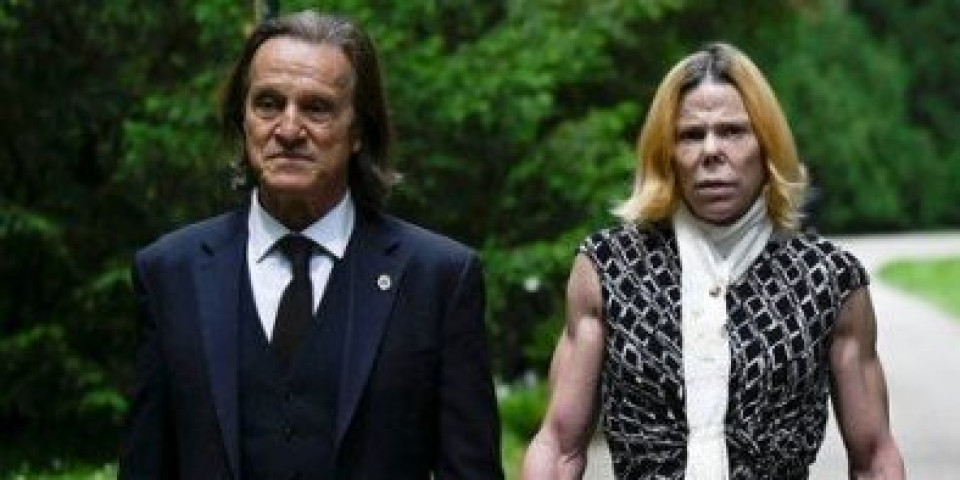 Zovu je najružnijom evropskom princezom: Doživela horor posle operacije, a evo kako je izgledala (FOTO)