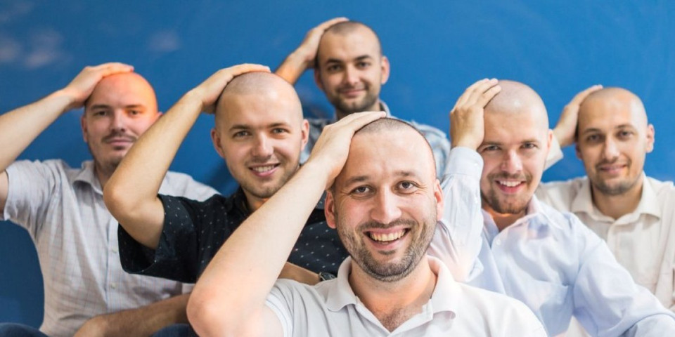 Konkurs koji je šokirao javnost: Kompanija zapošljavala samo ćelave - razlog će vas oduševiti