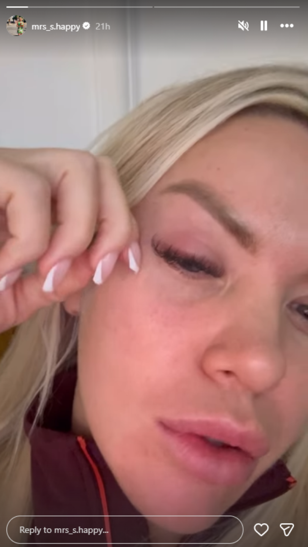 Voditeljka u bolovima molila za pomoć - Objavila snimak otečenog oka: "Ovo je strašno"