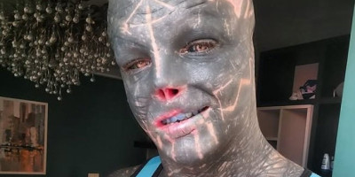 Entoni Lofredo (37) se transformisao u "crnog vanzemaljaca", pa je čak želeo da mu amputiraju nogu da bi ostvario svoj cilj.