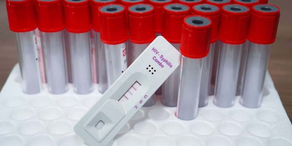 HIV otkriven kod 99 Srba, šest ljudi preminulo: Evo šta je najbitnije kod opake bolesti