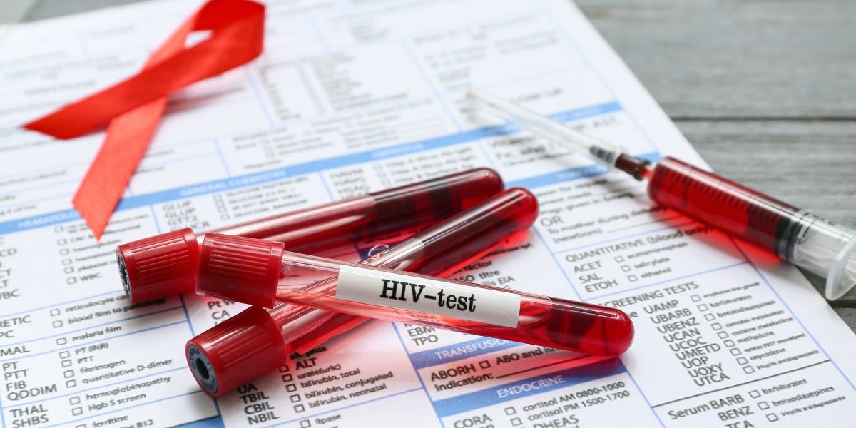 Balkan na nogama: HIV hara bivšim zemljama Jugoslavije - Ovde je najkritičnije