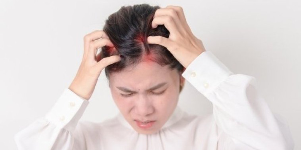 Svrbi vas koža glave? Vaše telo pokušava da vam ukaže na problem - obratite pažnju