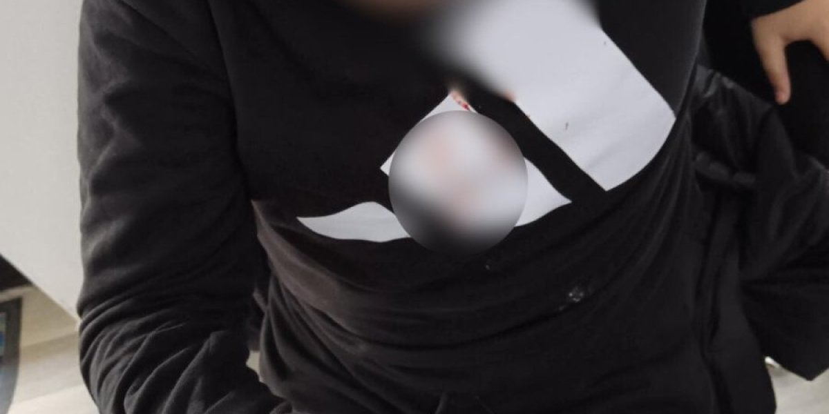 Pretučen dečak u Vlasotincu