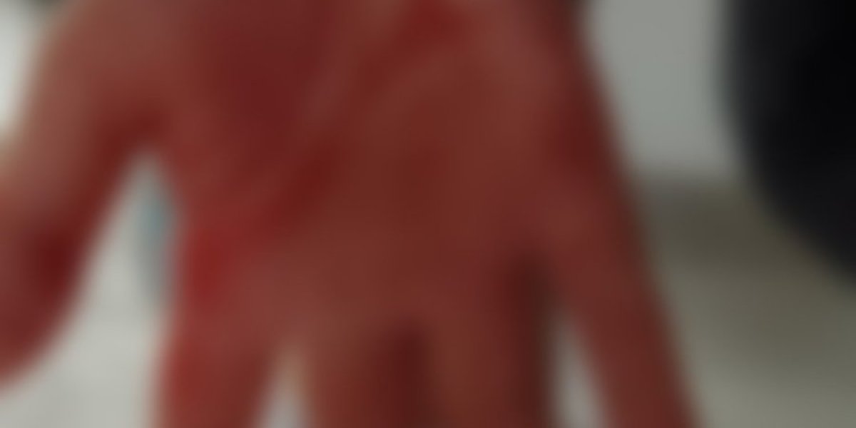 Pretučen dečak u Vlasotincu