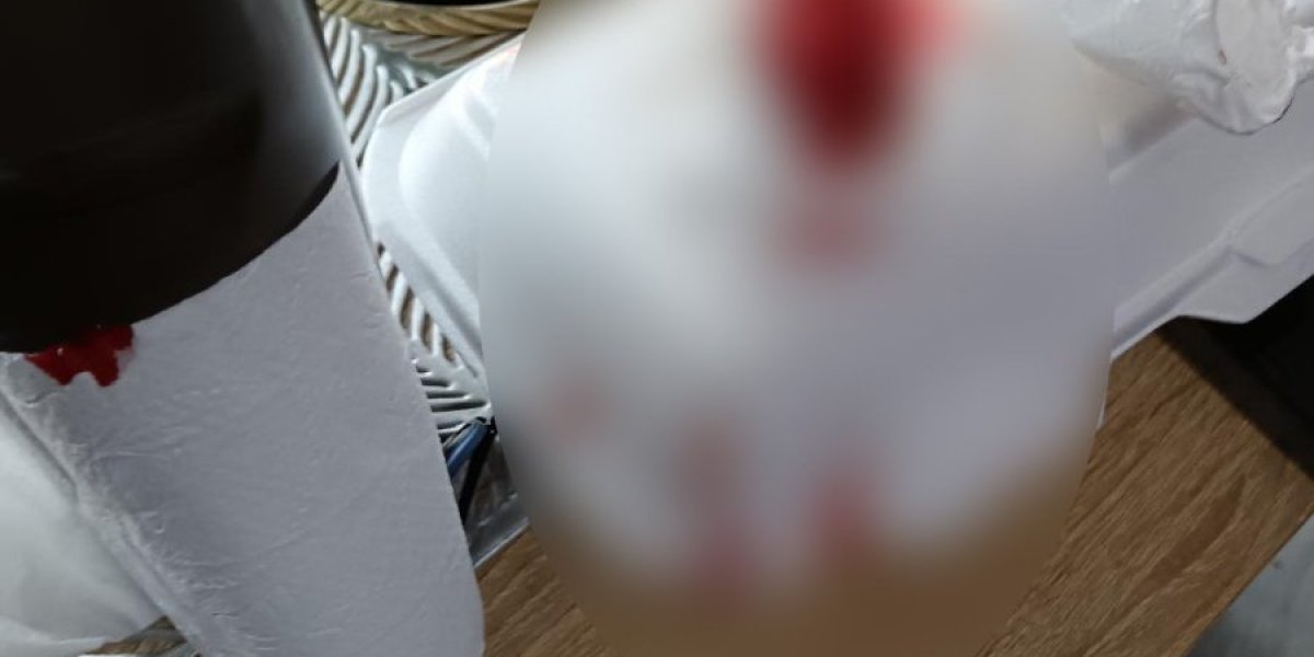 Pretučen dečak u Vlasotincu