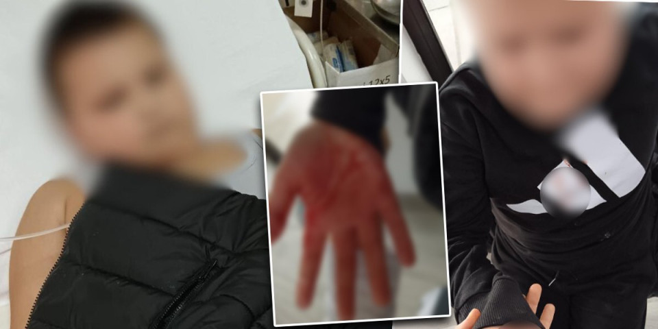 Od batina počeo da povraća i krvari: Učenik brutalno pretučen u Vlasotincu (FOTO)