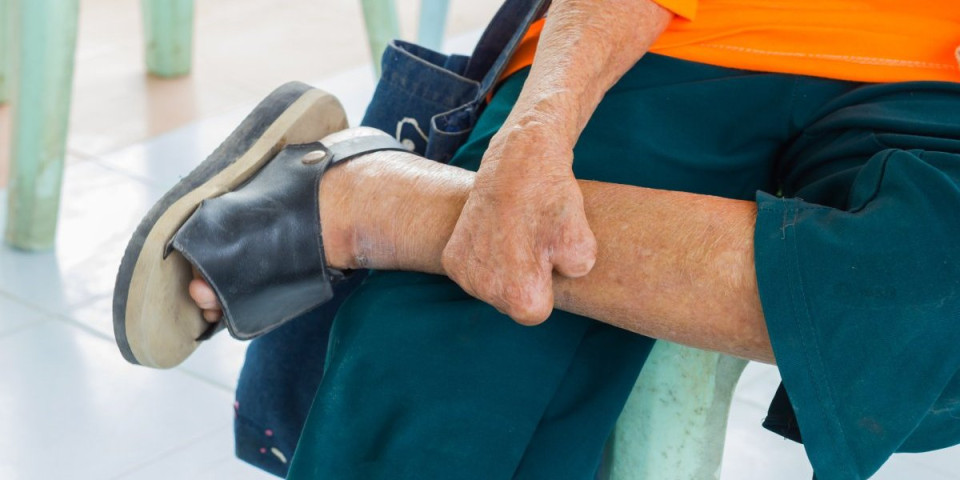 Poznato stanje pacijenta sa opasnom biblijskom zarazom! Oglasili se iz bolnica u srpskom komšiluku - Stanje je ovakvo...