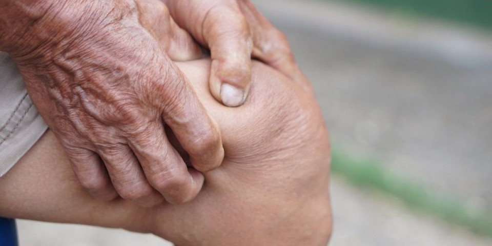 Ovaj recept rešava bolove od artritisa za 10 dana: Dovoljan je jedan tretman da osetite olakšanje