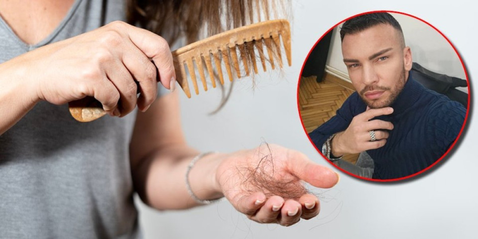 Frizer otkriva rešenje za opadanje kose: Princip koji provereno radi, odmah ga upotrebite