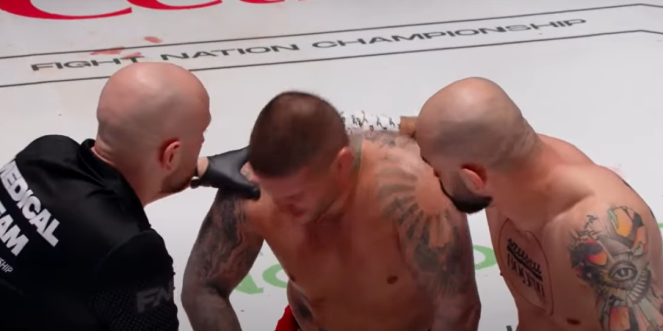 Bakočević doživeo tešku povredu oka? Crnogorac se oglasio usred noći iz bolnice (FOTO)