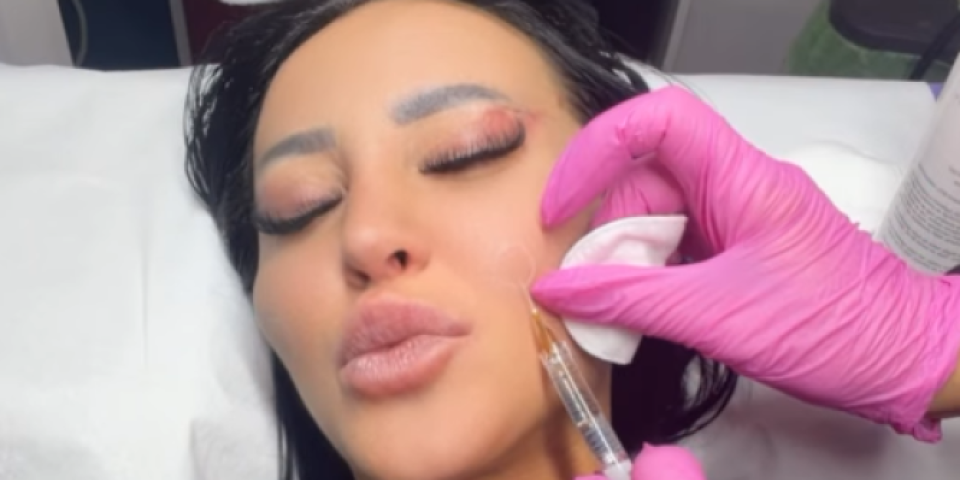 "Bolje plastični hirurg nego psihijatar": Starleta opet otišla pod nož, evo šta je radila