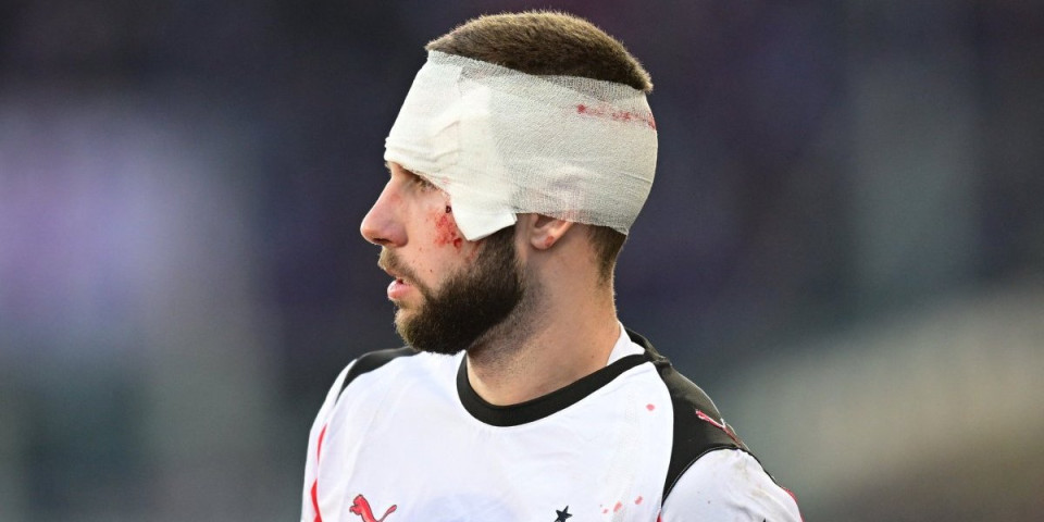 Prva fotografija Strahinje Pavlovića posle povrede glave (FOTO)