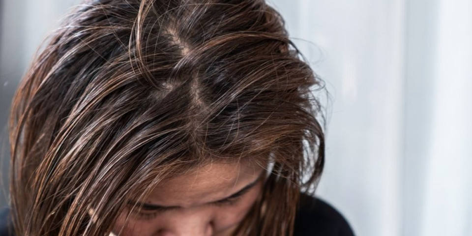 Ovo provereno rešava masnu kosu: Više nikada nećete cediti mast sa dlake i izgledati ulepljeno