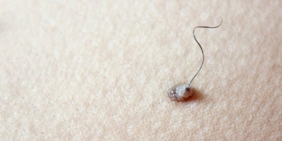 Zašto iz nekih mladeža raste dlaka? Normalno stanje ili znak upozorenja