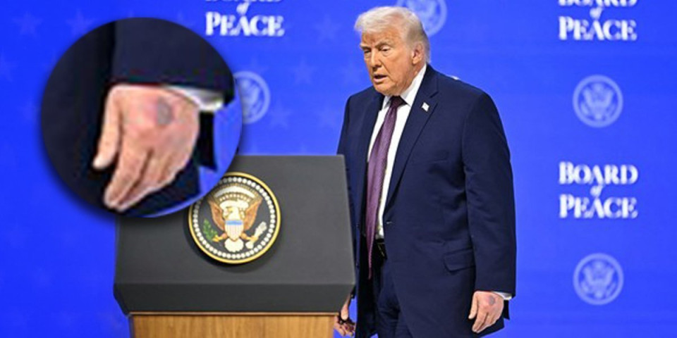 Tramp krije bolest?! Snimak iz Švajcarske koji je šokirao svet: Evo šta mu je to na ruci