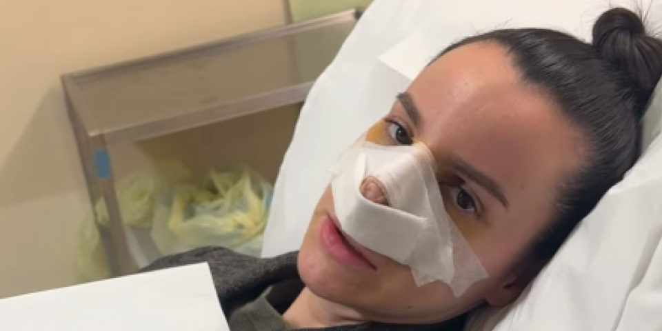 "Uništili su mi nos": Pevačica neprepoznatljiva, oglasila se iz bolnice (FOTO)