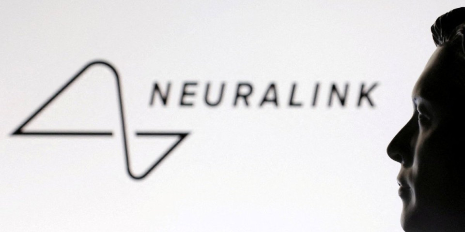 Čudi neviđeno! Paralizovan čovek prohodao u digitalnom svetu - Maskov čip mu ugradio robot, on sad mislima pomera sve