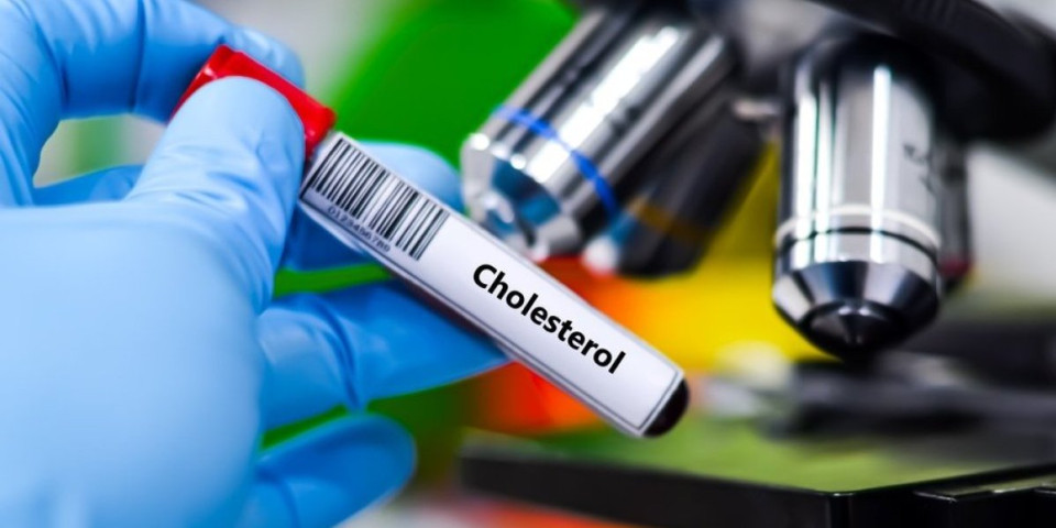 6 namirnica koje obaraju holesterol: Štite krvne sudove i čuvaju zdravlje srca