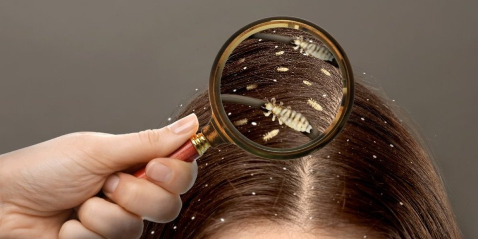 Sve što ste mislili da znate o vaškama - uglavnom nije tačno