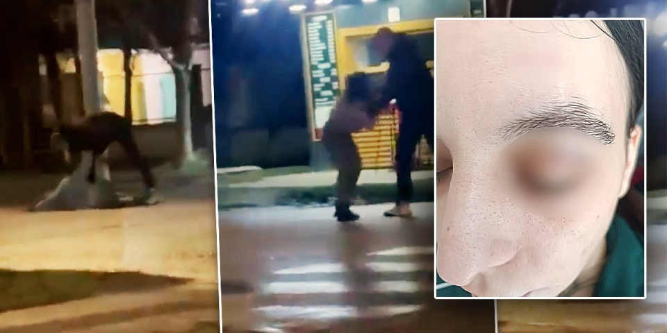 Ovo je pretučena Katarina: Golman je krvnički šutirao na ulici u Kikindi (FOTO)