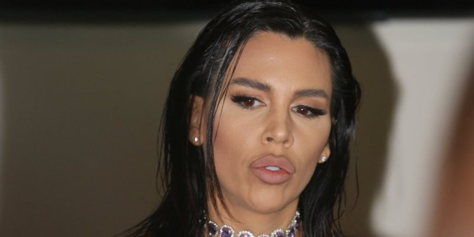 (FOTO) Lice Kaje Ostojić u jezivom stanju: Nakon tretmana za podmlađivanje pevačica neprepoznatljiva