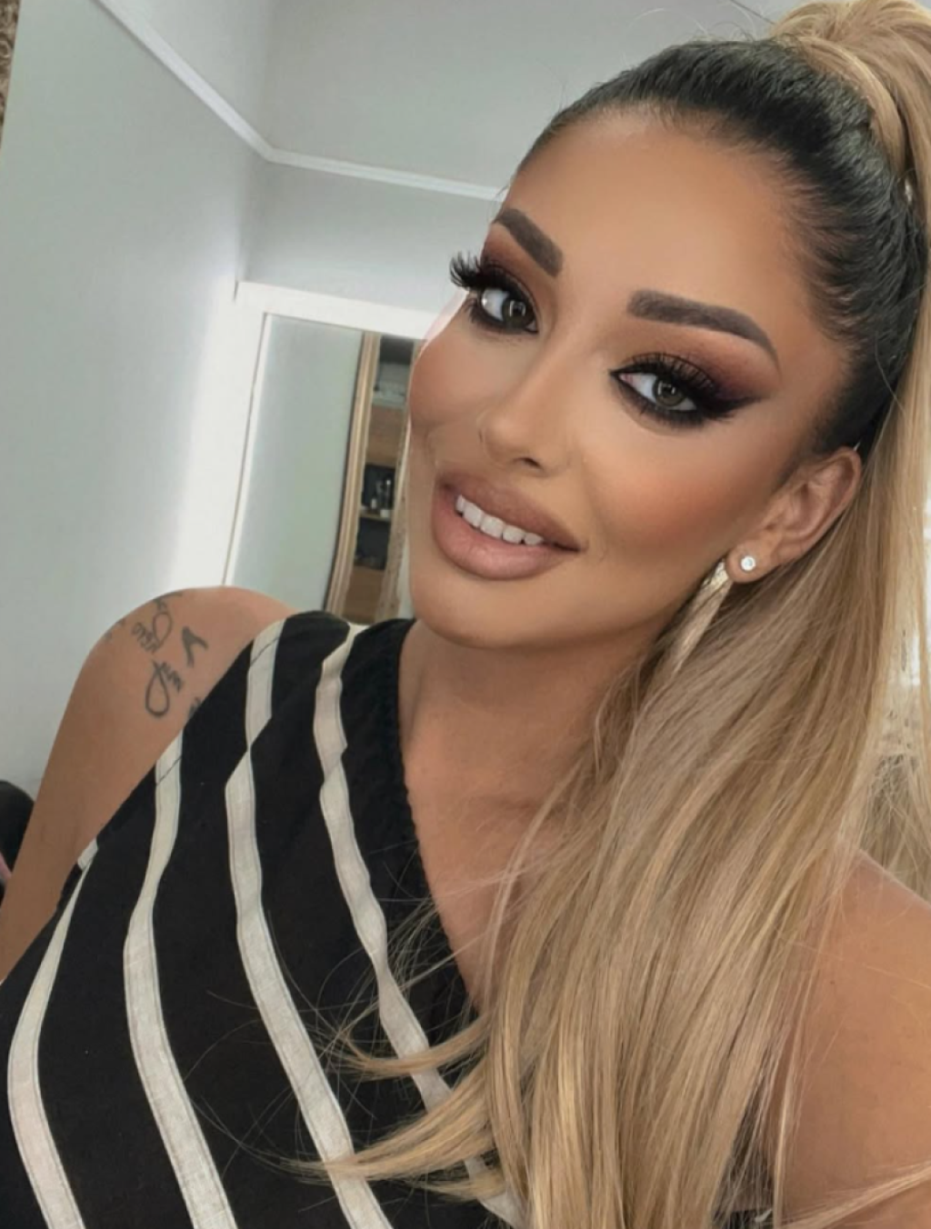 Zbog očevih zverskih batina završila na teškoj operaciji: "Sekli su mi rožnjaču na živo, kao slepa sam"