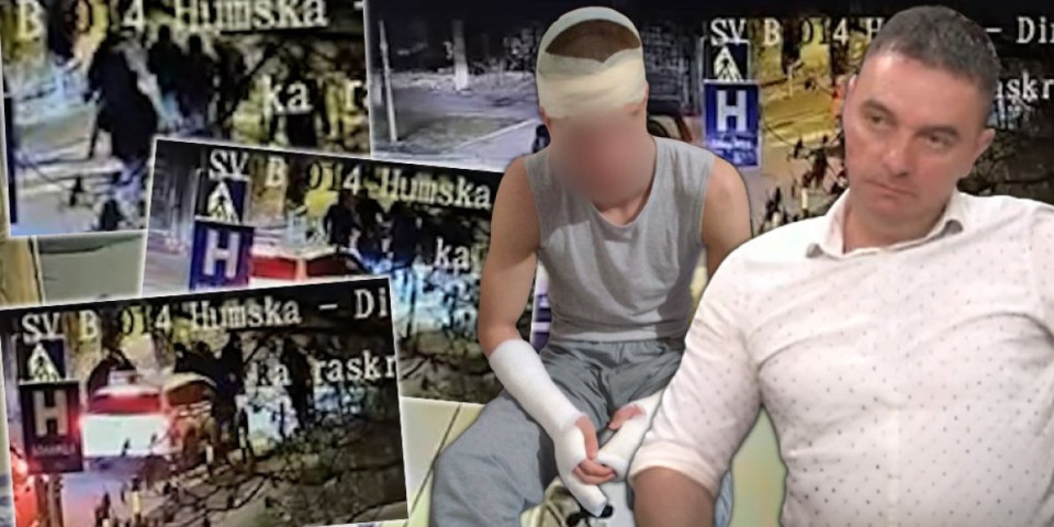 ''Ćaci, za koga sada navijaš?!'' Ispovest oca prebijenog tinejdžera u Humskoj: Hteli su da ga ubiju (VIDEO)