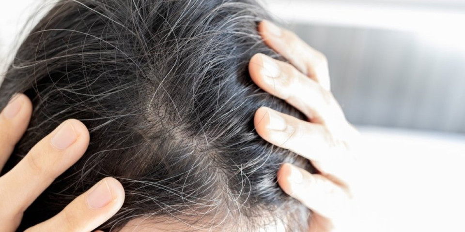 Da li treba čupati sede dlake? Frizeri upozoravaju na greške koje mogu uništiti vašu kosu