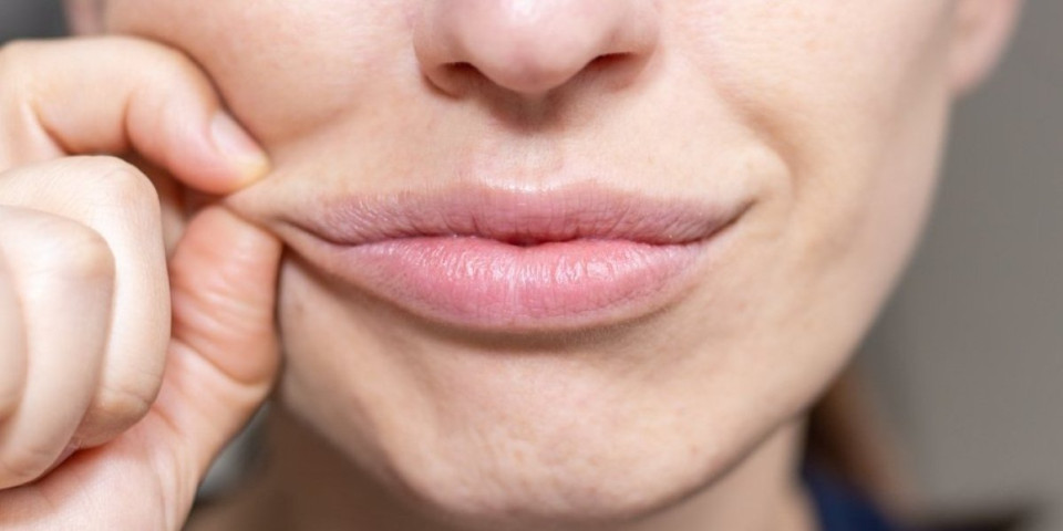 Bore oko usana su prvi znak starenja: Dermatolozi otkrili trikove za mladalački izgled