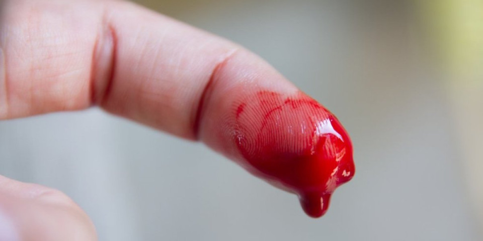 Lekari upozoravaju: Ove vrste krvarenja mogu biti znak raka - ne ignorišite signale